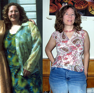 Alyce, before and after 80 pounds (Click to enlarge)