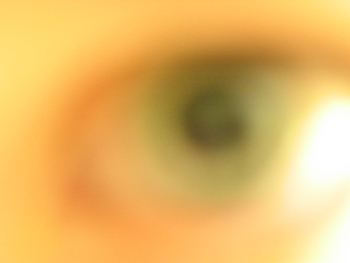 Blurry eye (Click to enlarge)